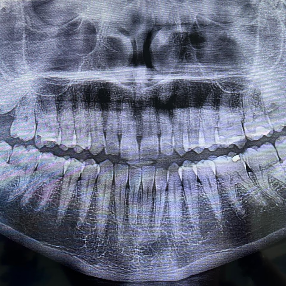 Esami Radiografici Digitali